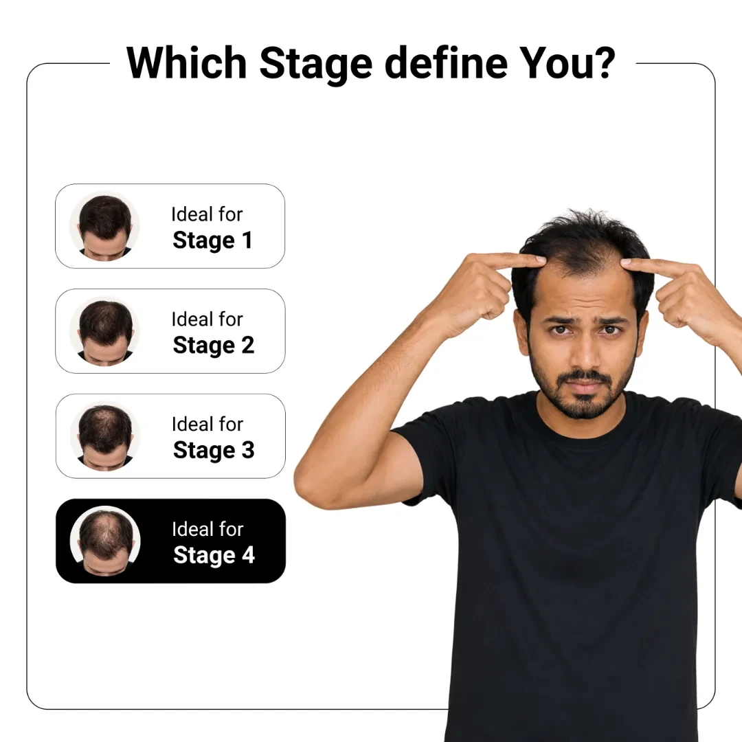 Advanced Hair Fall Control Combo 5
