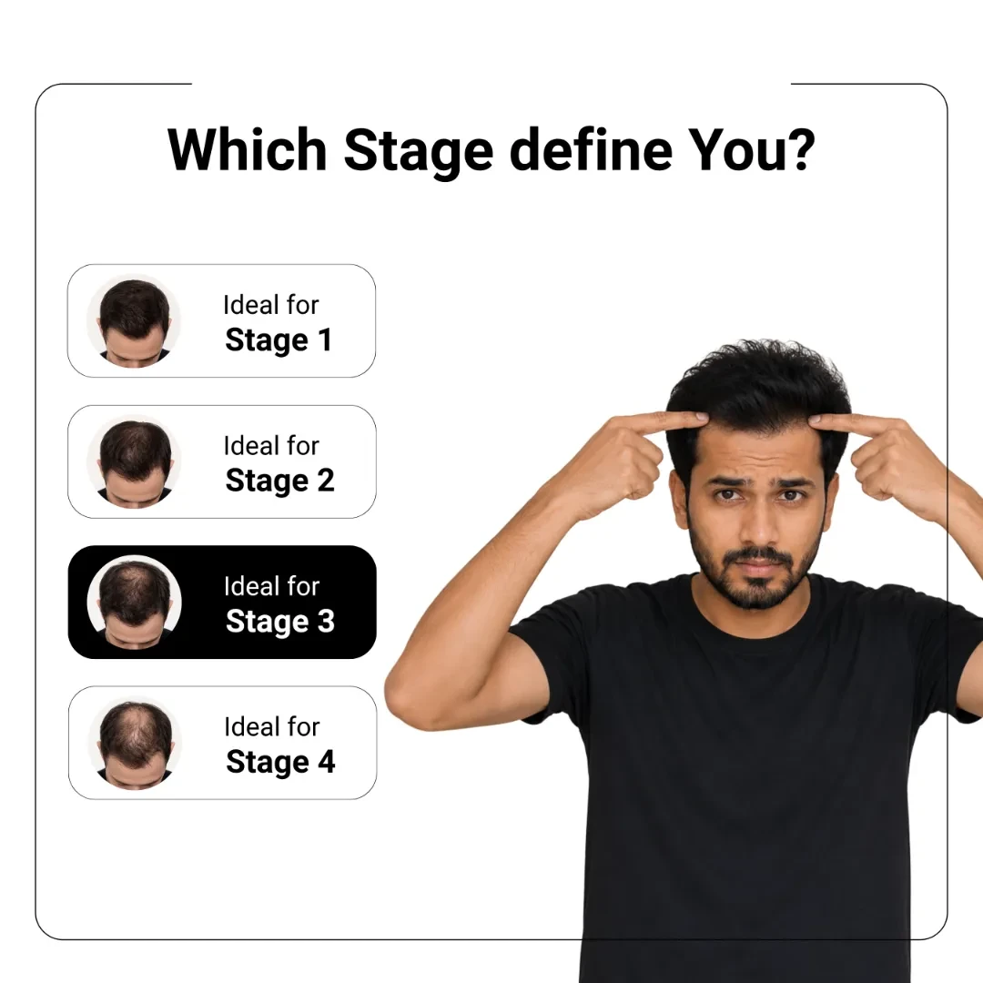 Stage 3 Hair Regrowth Kit 2